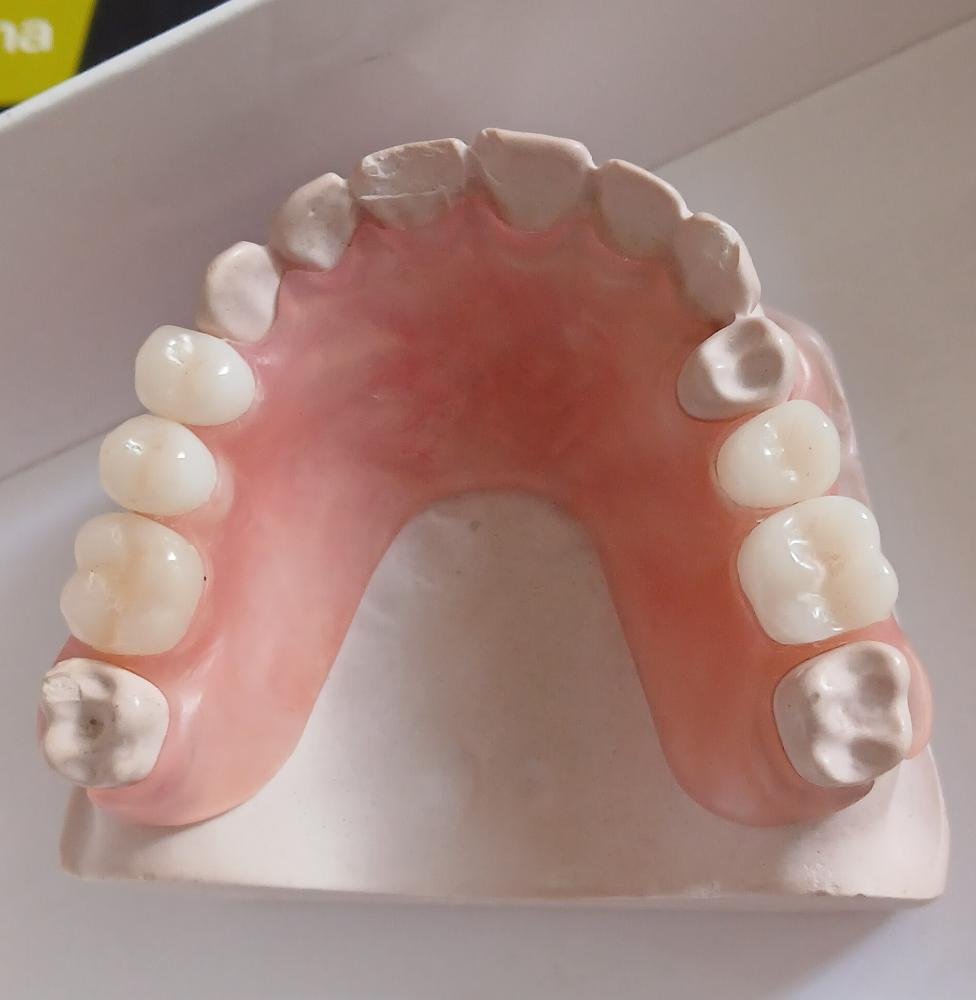 Prótesis Dental Especializada